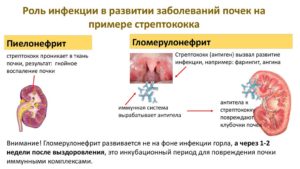 Пиелонефрит почек от чего бывает. Реабилитация после болезни. Причины возникновения пиелонефрита