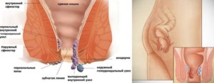 Почему чешется сфинктер. Причины зуда в заднем проходе