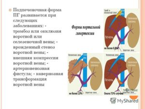 Селезеночная вена норма. Что такое тромбоз селезеночной вены