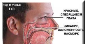 Причины и лечение постоянного зуда носа снаружи. Зуд в носу, чихание, насморк — о чем говорят симптомы