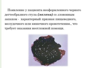 Рак желудка черный кал. Кал чёрного цвета: о чём это говорит у женщин у мужчин, что делать