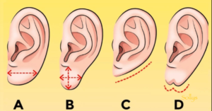 Какие мочки ушей бывают. Как узнать характер по форме ушей