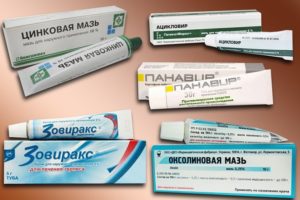 Как избавиться от малярии на губе: мази, таблетки и народные средства. Средства, применяемые для профилактики и лечения малярии
