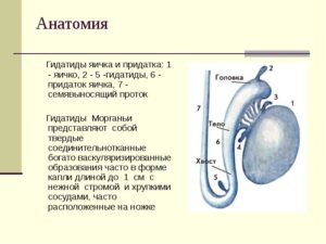 Перекрут гидатиды яичка: что это такое, диагностика заболевания, лечение. Причины возникновения и лечение гидатиды яичника