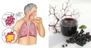Как избавиться от бронхиальной астмы. Как вылечить астму: можно ли избавиться навсегда в домашних условиях