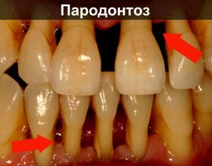 Почему чешутся зубы у взрослого и что это может значить? Что делать, если у взрослого чешутся зубы