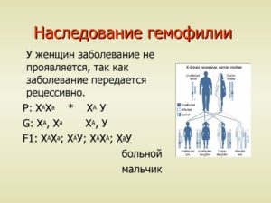 Гемофилия определяется рецессивным признаком. Наследственные заболевания у ребенка: гемофилия