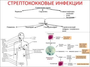 Анализ на стрептококк в инвитро. Стрептококковые инфекции: симптомы, лечение