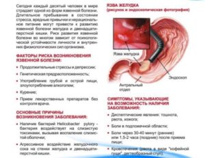 Витамины при язве желудка какие. Язва желудка: причины и симптомы. Профилактика язвы желудка