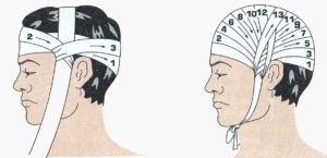 Медицинская повязка на голову как называется. Повязка чепец - техника наложения. Десмургия