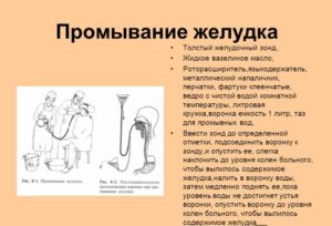 Как промывают желудок в больнице. Как прочистить желудок в домашних условиях