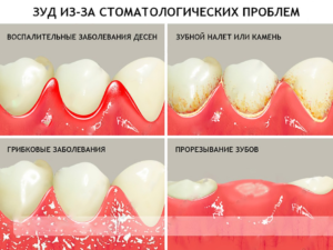 Почему чешутся зубы у взрослого и что это может значить? Что делать, если у взрослого чешутся зубы