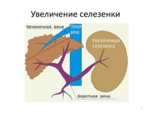 Селезеночная вена норма. Что такое тромбоз селезеночной вены