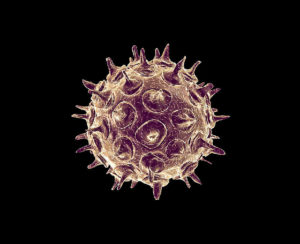 Инфекция, вызываемая вирусом варицелла-зостер. Вирус Варицелла-Зостер — возбудитель ветряной оспы и опоясывающего лишая: подробная клиническая картина