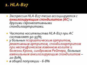 Анкилозирующий спондилит hla b27. HLA-B27 - что это? Выявление гена гистосовместимости