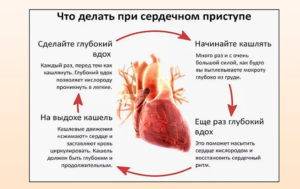 Чем снять сердечную боль в домашних условиях. Болит сердце: что делать