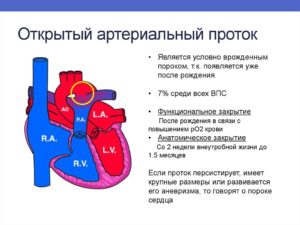 Порок сердца незаращение боталлова протока. Открытый артериальный Боталлов проток (ОАП): причины незаращения у детей, симптомы, как лечить