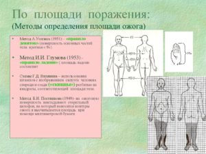 Ожоги: площадь ожогов, определение по правилу ладони. Классификация ожогов по площади и степени поражения. Методы определения площади ожога