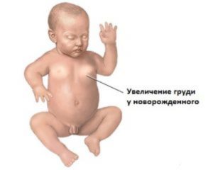 Проблемы молочных желез у грудных детей: набухание, уплотнение или увеличение. Уплотнение в груди у ребенка