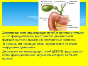 Основные симптомы запоров из за желчного пузыря