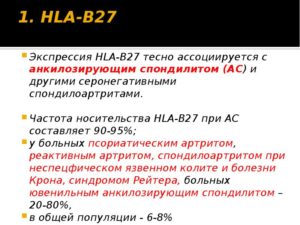 Анкилозирующий спондилит hla b27. HLA-B27 - что это? Выявление гена гистосовместимости