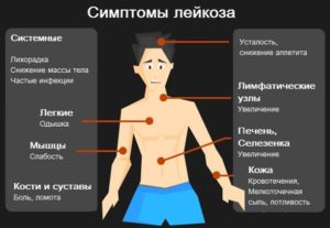 Можно ли вылечить лейкемию или нет. Лейкоз крови у взрослых: первые признаки и симптомы, причины болезни, лечение