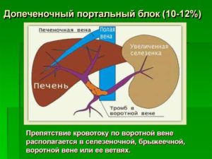 Селезеночная вена норма. Что такое тромбоз селезеночной вены