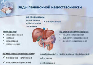 Печеночная недостаточность симптомы у мужчин. Симптомы и стадии печеночной недостаточности