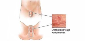 Почему половые губы темнеют, какого должны быть они цвета? Синие половые губы