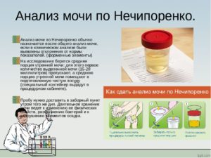 Какие болезни показывает анализ мочи. Как собрать и сдать общий анализ мочи правильно