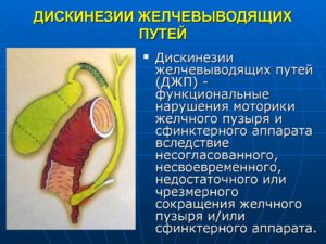 Лечение дискинезии желчевыводящих путей народными средствами. Как лечить дискинезию желчевыводящих путей народными средствами