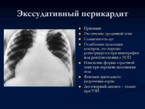 Что такое гидроперикард, причины возникновения и опасность. Гидроперикардит сердца: лечение и причины Травмы грудной клетки