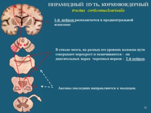 Пирамидальный путь неврология. Пирамидный путь. Центральный и периферический нейрон. Симптомы поражения пирамидного пути на уровне ствола мозга