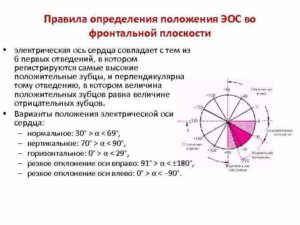 Пограничное отклонение эос влево во фронтальной плоскости. Показатели определения приведены ниже. С какой целью определяется ЭОС