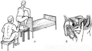 Стимулирование простаты. Как стимулировать работу простаты своими руками: техника выполнения