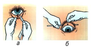 Соринка под веком как вытащить. Если в глаз попала соринка — что делать и как оказать первую помощь? Что делать с вонзившейся в глаз соринкой