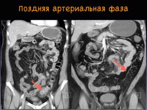 МРТ брюшной полости и забрюшинного пространства: отзывы. МРТ брюшной полости: что входит? Правильная подготовка к МРТ брюшной полости – залог достоверного диагноза Мрт брюшной и забрюшинной полости что показывает