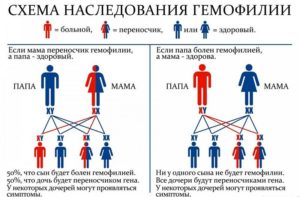 Гемофилия определяется рецессивным признаком. Наследственные заболевания у ребенка: гемофилия