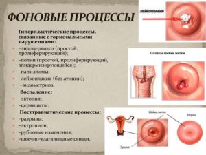 Рубцовая деформация шейки матки - причины и лечение. Самое важное про рубец на матке