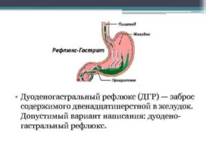 Эритематозная гастропатия на фоне атрофичной слизистой