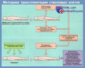 Пересадка мозга в другое тело. Пересадка мозга. Забор донорской кроветворной ткани