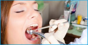 Удаление зуба при беременности. Что делать после удаления зуба при беременности. Можно ли во время беременности удалять зуб с использованием анестезии, на какой срок отложить операцию