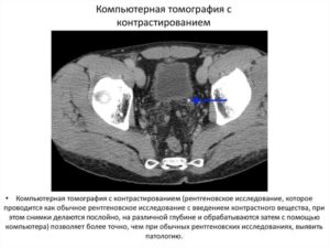 Кто должен вводить контрастное вещество. КТ с контрастным усилением — что покажет исследование? Вредно ли контрастное вещество