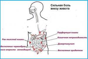 Почему боли внизу живота у мужчин. Причины болей внизу живота у мужчин