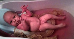 Можно ли мыть лицо новорожденному раствором марганцовки. Как развести марганцовку для купания новорожденного