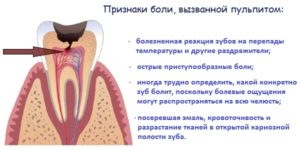 Может ли быть температура от зубной боли у взрослых и детей: симптомы и лечение. Может ли подняться температура от зубной боли