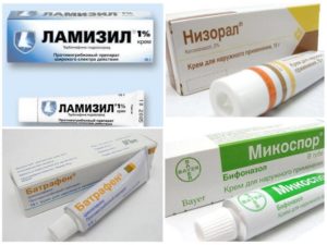 Противогрибковые препараты — недорогие, но эффективные. Противогрибковые мази для кожи. Самые эффективные