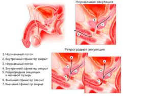 Что такое мужское семя. Как происходит семяизвержение у мужчин? Плюсы и минусы семенной жидкости во влагалище