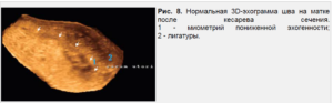Узи шва после кесарева сечения когда делать. Как делают УЗИ матки после родов и какова норма основных показателей