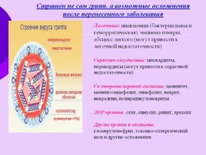 Осложнение на сердце после гриппа. Возможные осложнения на сердце после гриппа